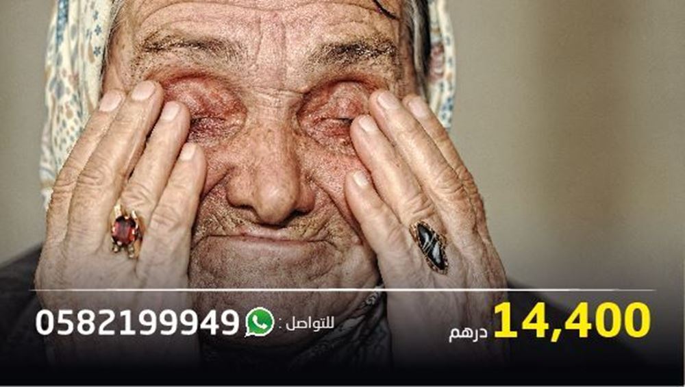 صورة امرأة تحتاج لعملية لإزالة المياه البيضاء من العين وبحاجة لعلاج خرق في العين- رقم المشروع 8989/2021