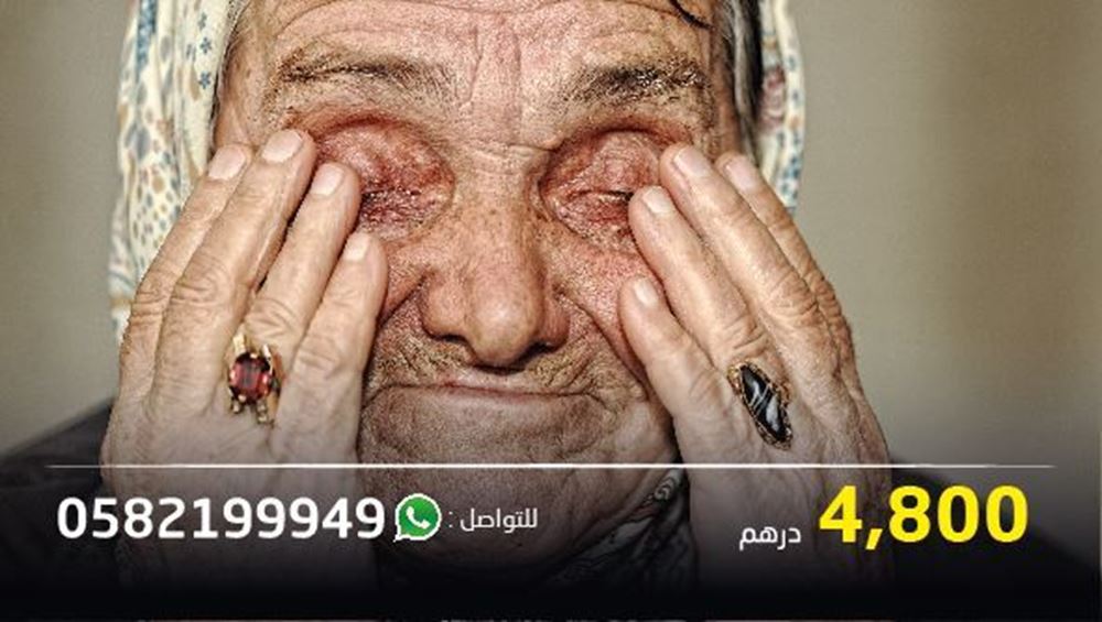 Picture of An elderly woman needs an eye operation- Project No. 8993/2021
