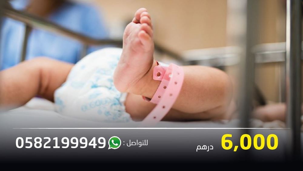صورة مساعدة علاجية لطفل رضيع يعاني من تشوه ولادي فى مجري البول - مصر