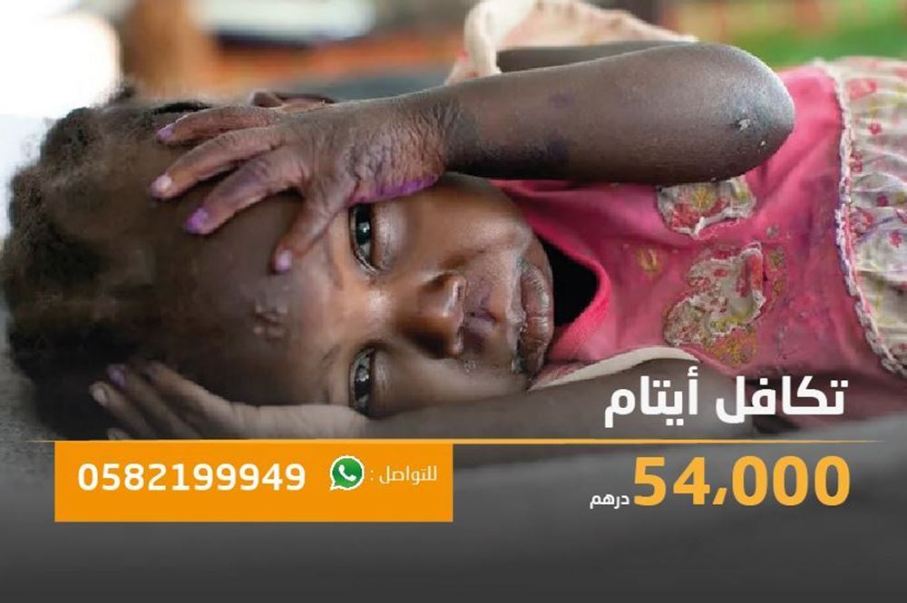 صورة اليتيمة الاء اصيبت بشلل بسبب تأخر العلاج - السودان