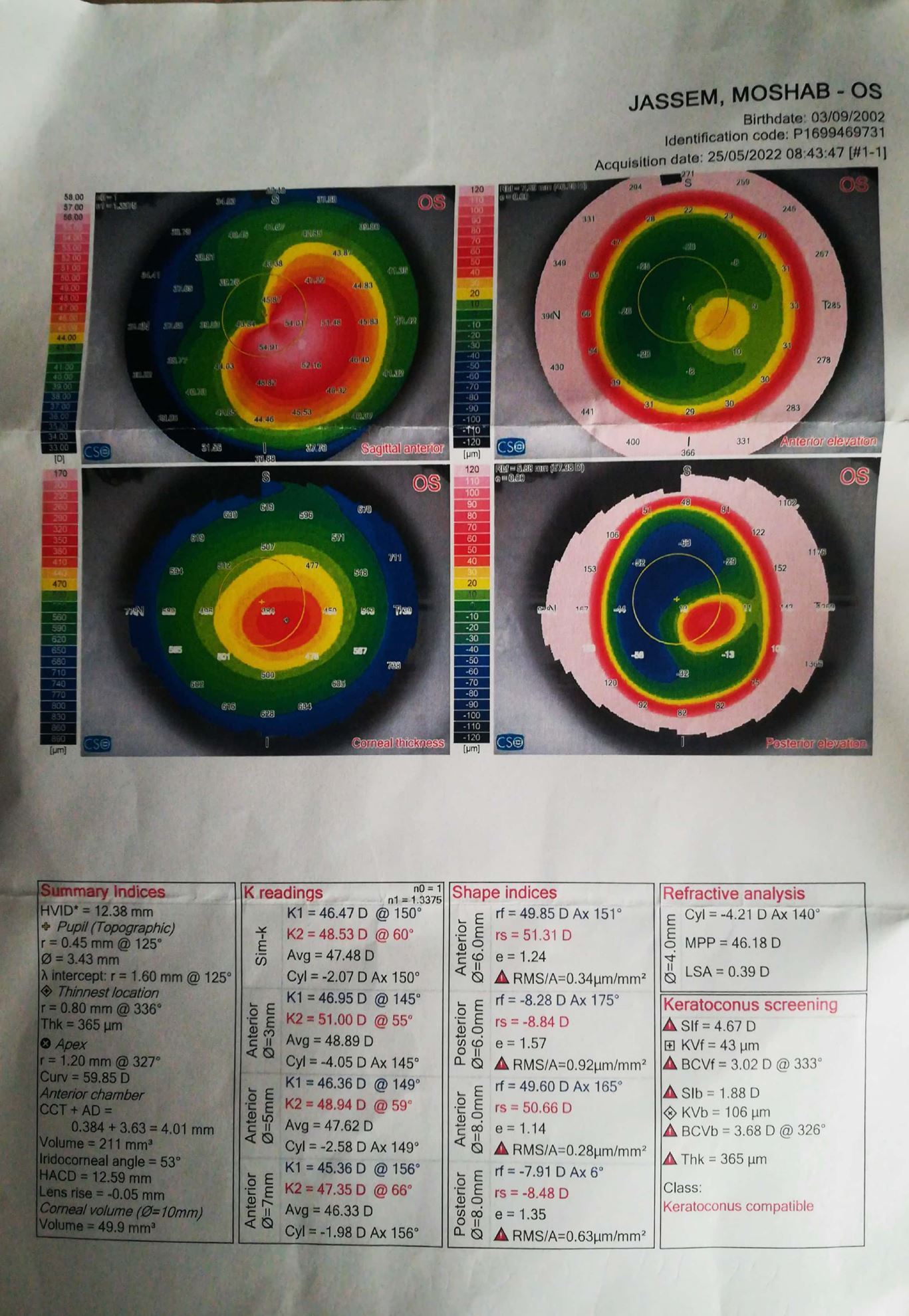 Therapeutic assistance / eye surgery International Charity Organization