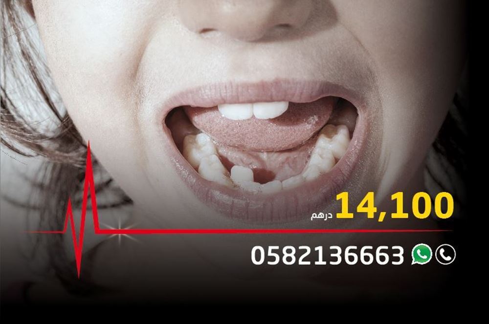 صورة اجراء عملية جراحية لخلع اسنان سفلية وعلوية لتعديل نطق الحروف لليتيمة دانه