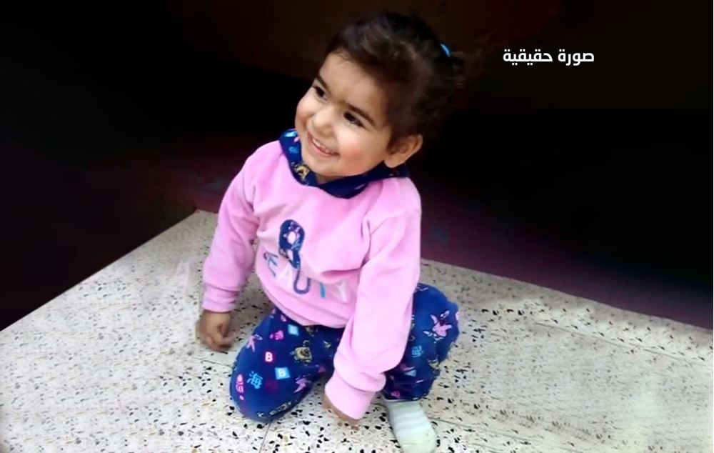 صورة طفلة تعاني من التواء في العمود الفقري