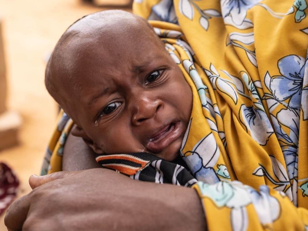 صورة مرض الطفولة