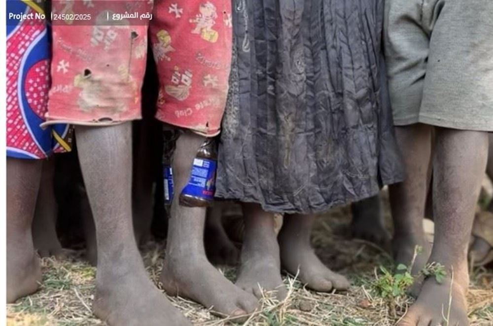 صورة أحذية لأطفال فقراء