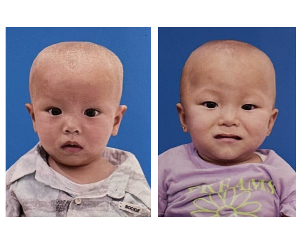 صورة أيتام  رضع - توأم