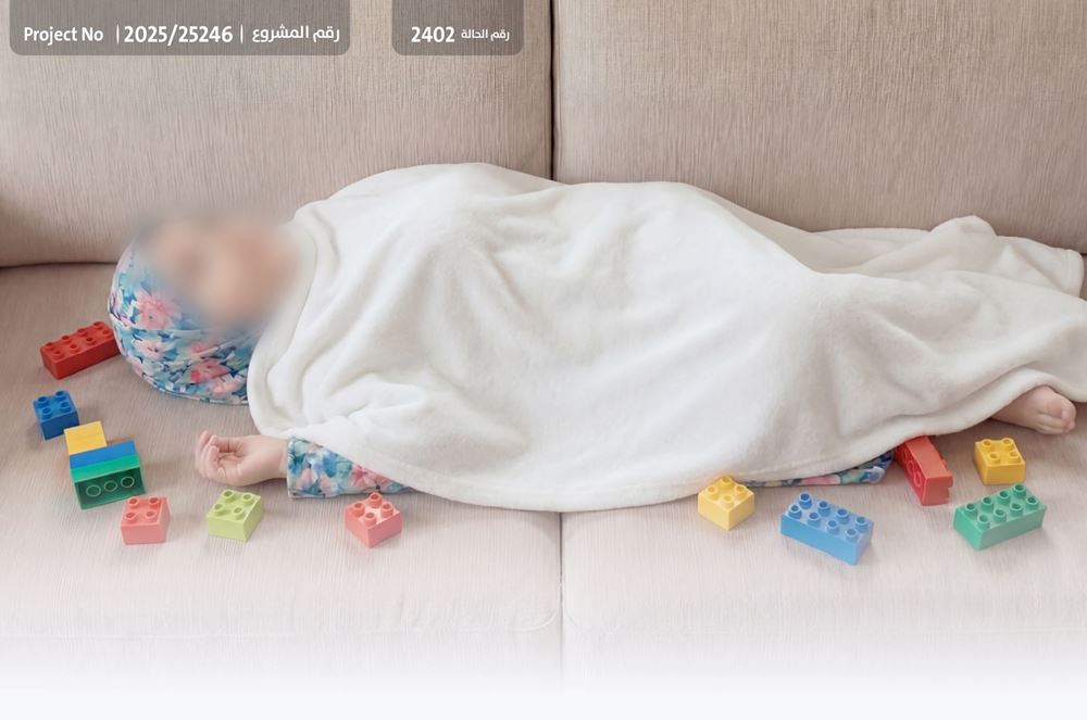 صورة طفلة  متلازمة داون بحاجة لعونكم