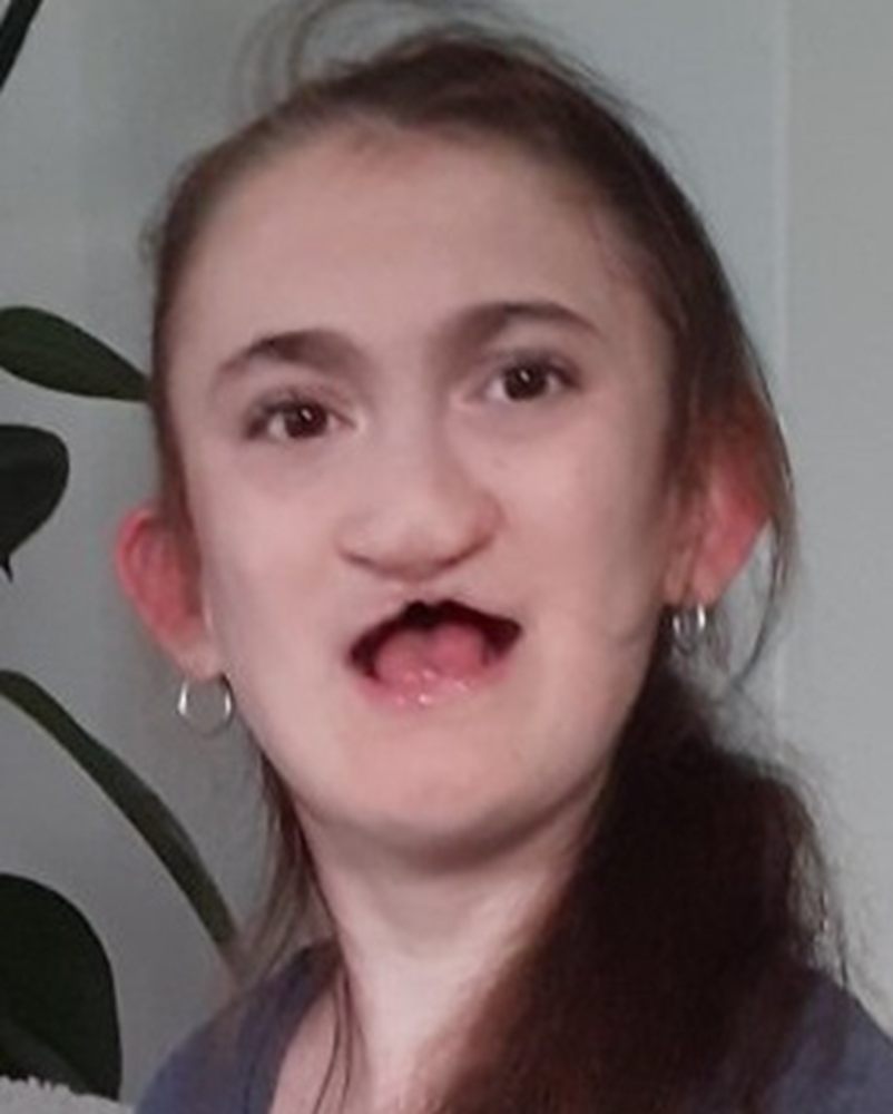 صورة المريضة -  اينا - 1572940