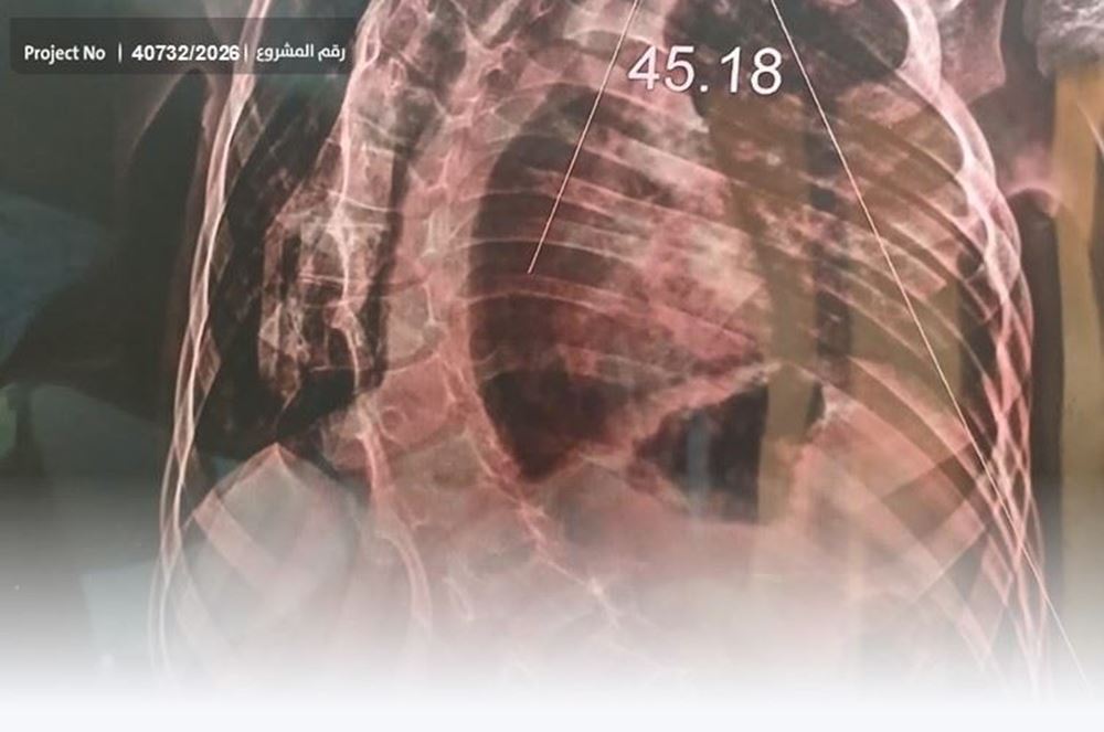 Picture of A weary body and a heart full of hope await help.