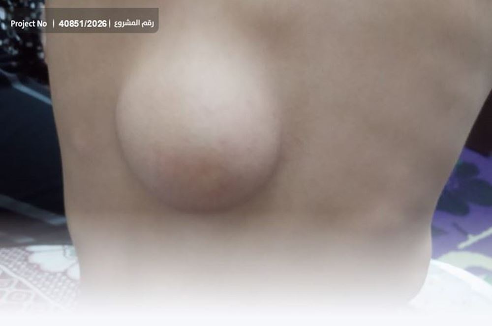 Picture of A ten-year-old child battles tumors and pain