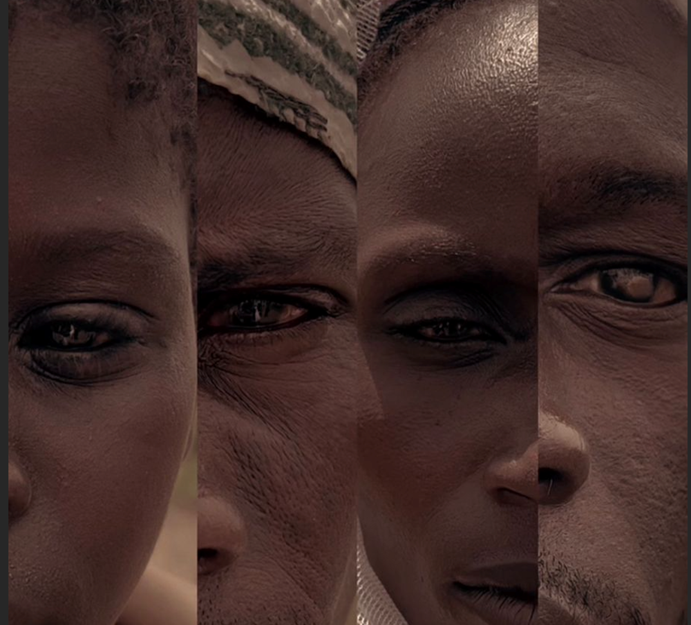 صورة إجراء عملية إزالة المياه البيضاء للمرضى