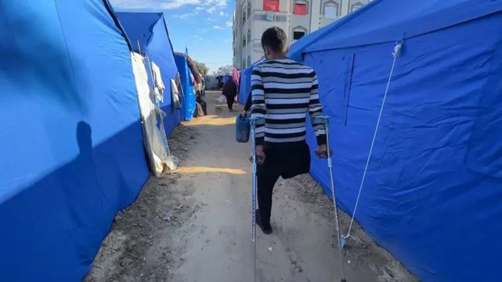 صورة أطراف صناعية لمرضى في غزة