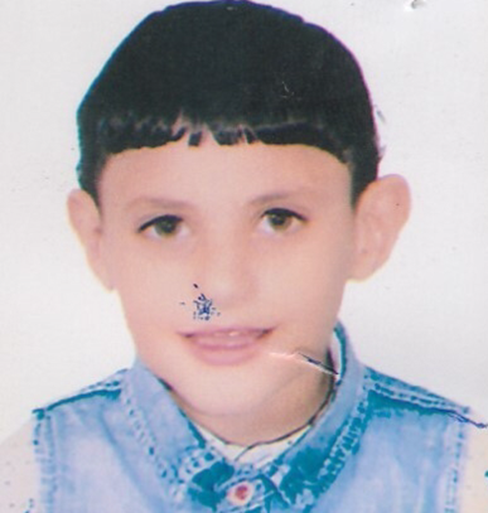 صورة المريض - ادم - 1310998